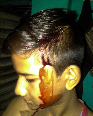 درخواست کمک پدری که پسرش دچار خونریزی از سر صورتش است+ گزارش تصویری