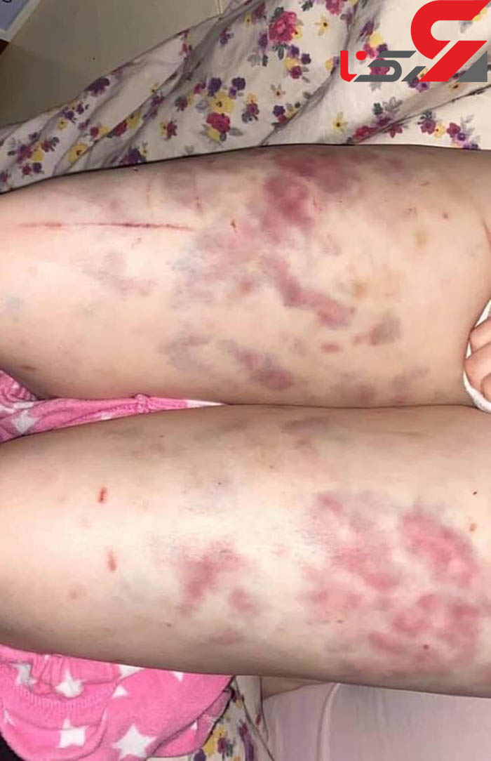 شکنجه بی رحمانه و تجاوز گروهی به دختر جوان/عکس 1 تجاوز