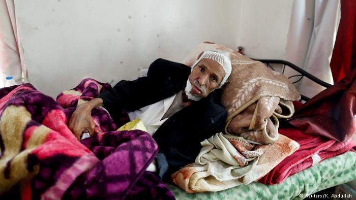 از قطع دست دختر یمنی به خاطر سرطان تا آوارگی پیرمردی با تومور مرگبار در دهان 