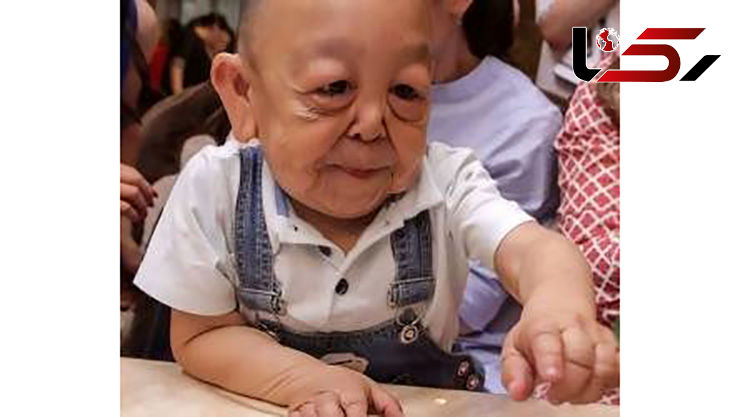 پیرمردی که فقط 6 سال دارد! + تصاویر باورنکردنی