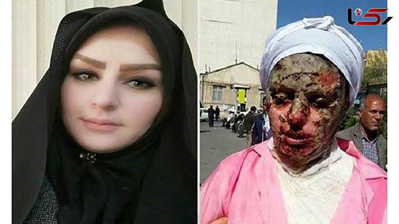 جزئیات مرگ عامل اسیدپاشی به دختر تبریزی در زندان + عکس چهره معصومه قبل و بعد از اسیدپاشی 