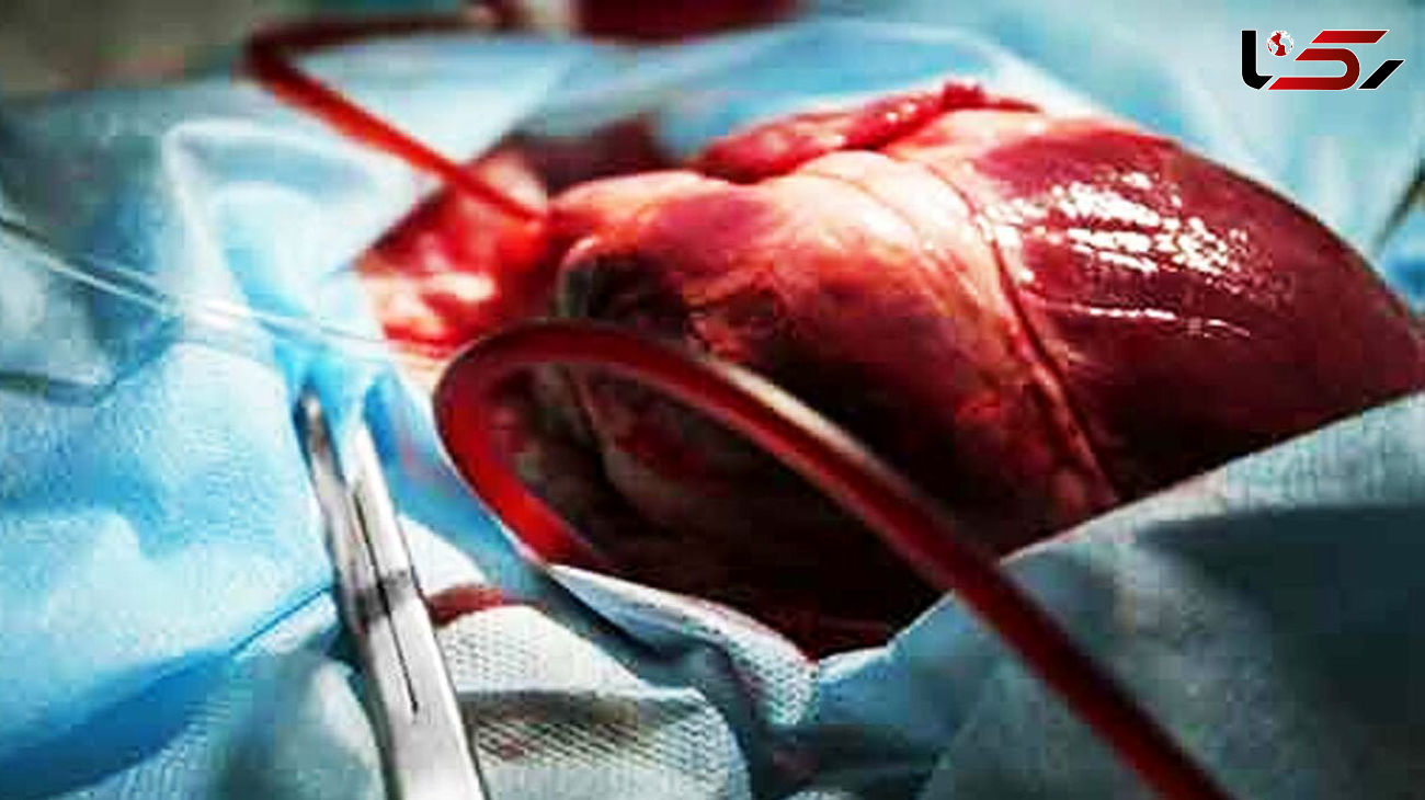 چطور قبل از پیوند از قلب نگهداری می شود؟ + فیلم