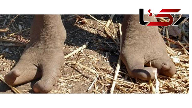 Ø§Ø¹Ø¶Ø§Û Ø§ÛÙ ÙØ¨ÛÙÙ Ø¨Ù Ø¬Ø§Û Ù¾Ø§ Ø³ÙÙ Ø¯Ø§Ø±ÙØ¯ + Ø¹Ú&copy;Ø³ ÙØ§Û Ø¨Ø§ÙØ±ÙÚ&copy;Ø±Ø¯ÙÛ