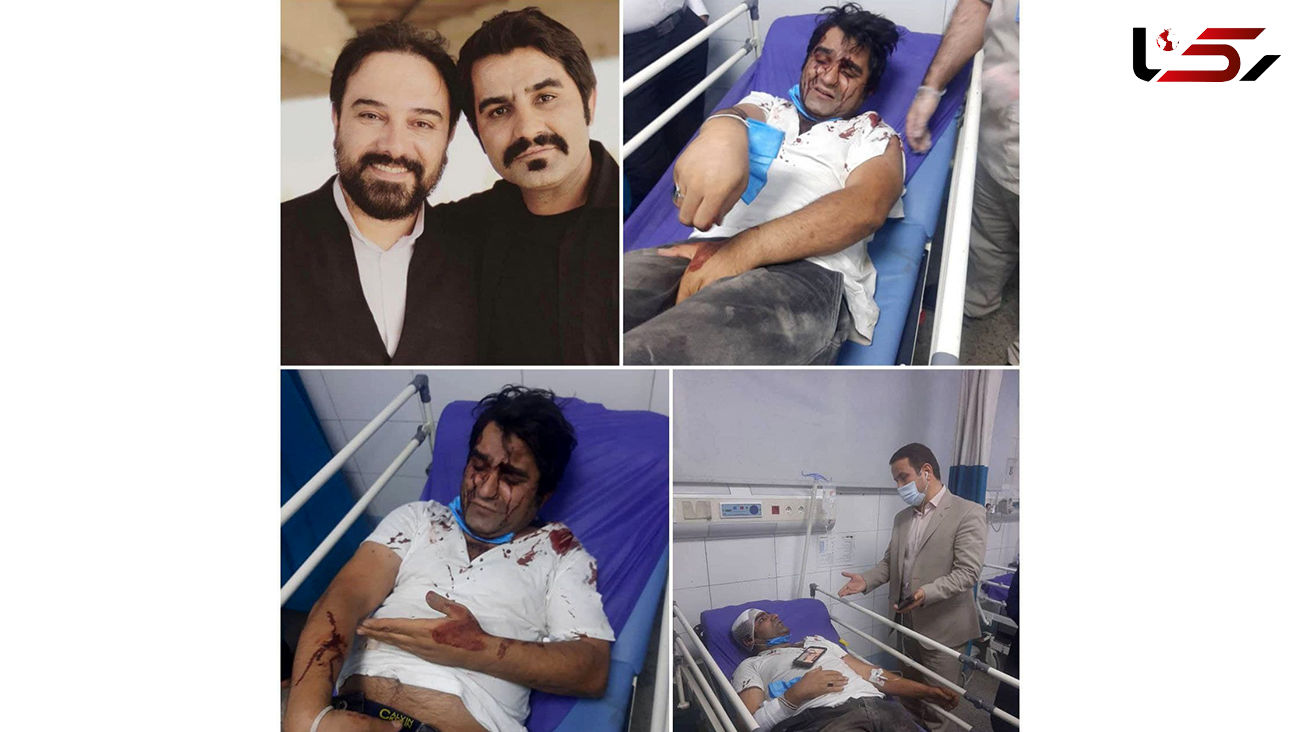 حمله خونین به 2 بازیگر سریال دودکش + عکس ها