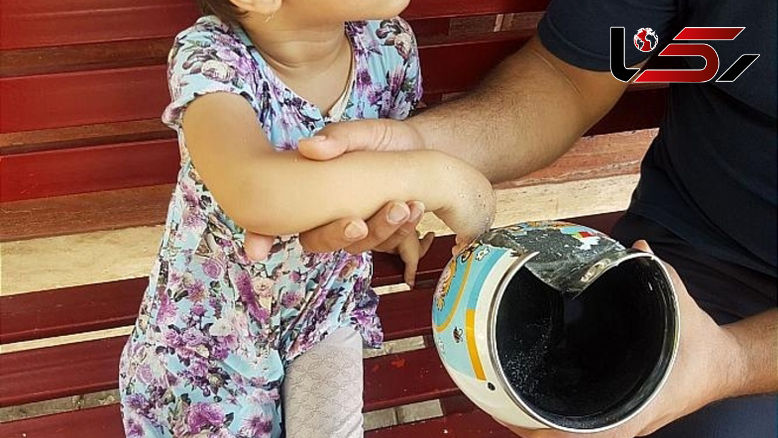 نجات انگشت کودک از لوله کتری در تهران + عکس